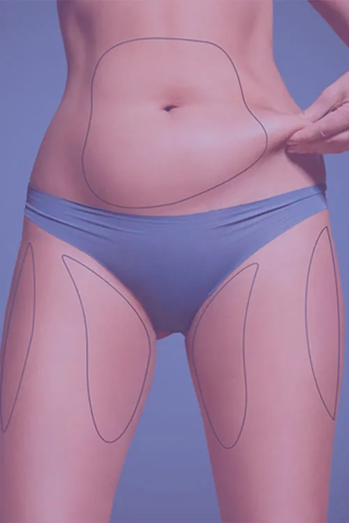Liponormal