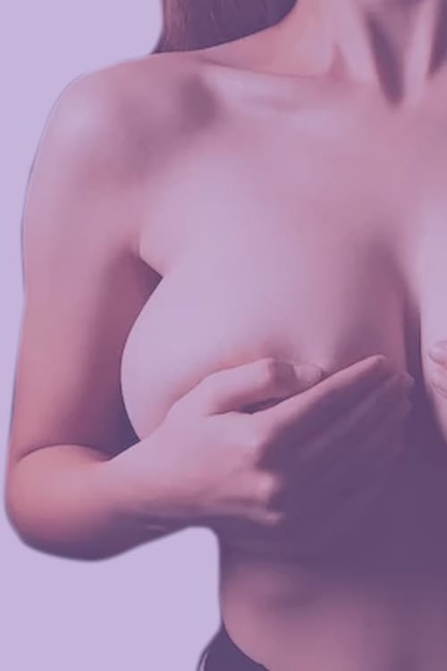 Mamo redutora LP Niandra