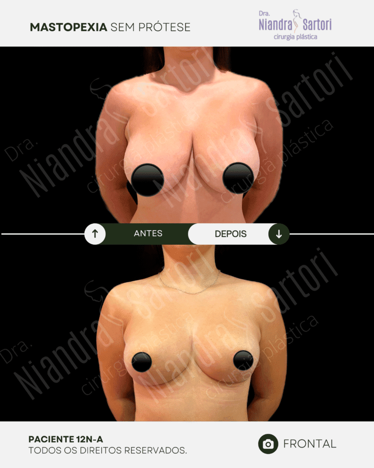 Mamas 15 NS_PACIENTE 12N-A