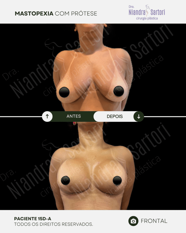 Mamas 13 NS_PACIENTE 15D-A