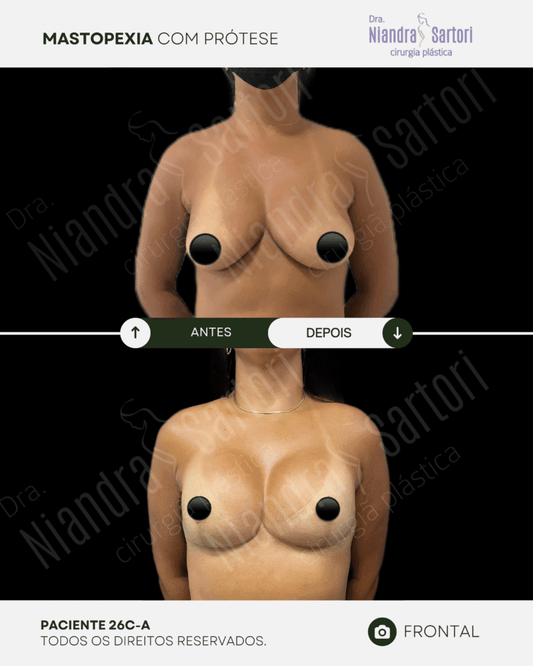 Mamas 12 NS_PACIENTE 26C-A