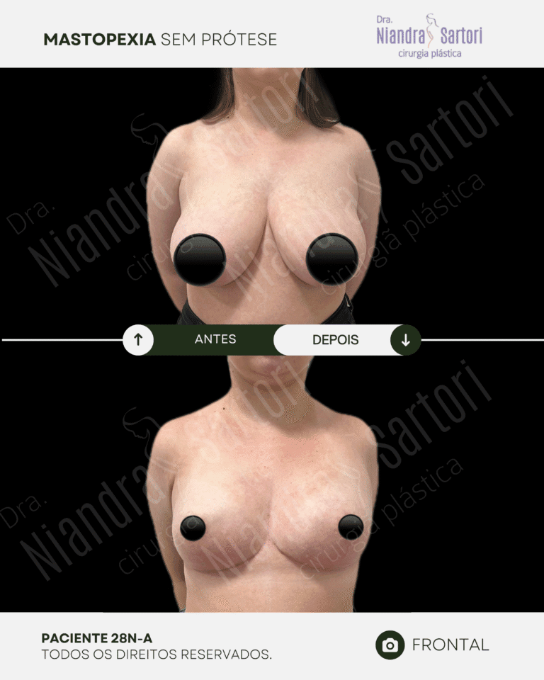 Mamas 17 NS_PACIENTE 28N-A