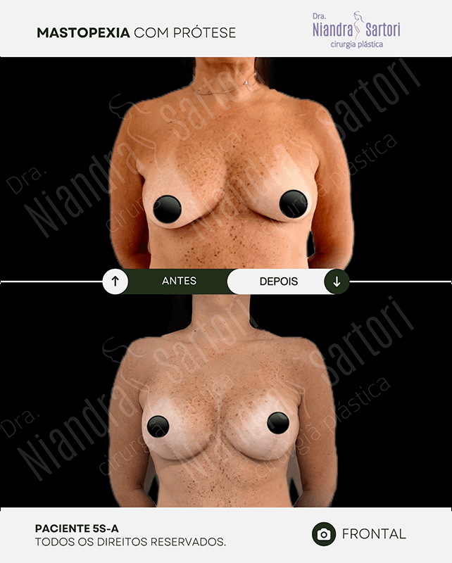 Mamas 4 NS PACIENTE 5S A 2