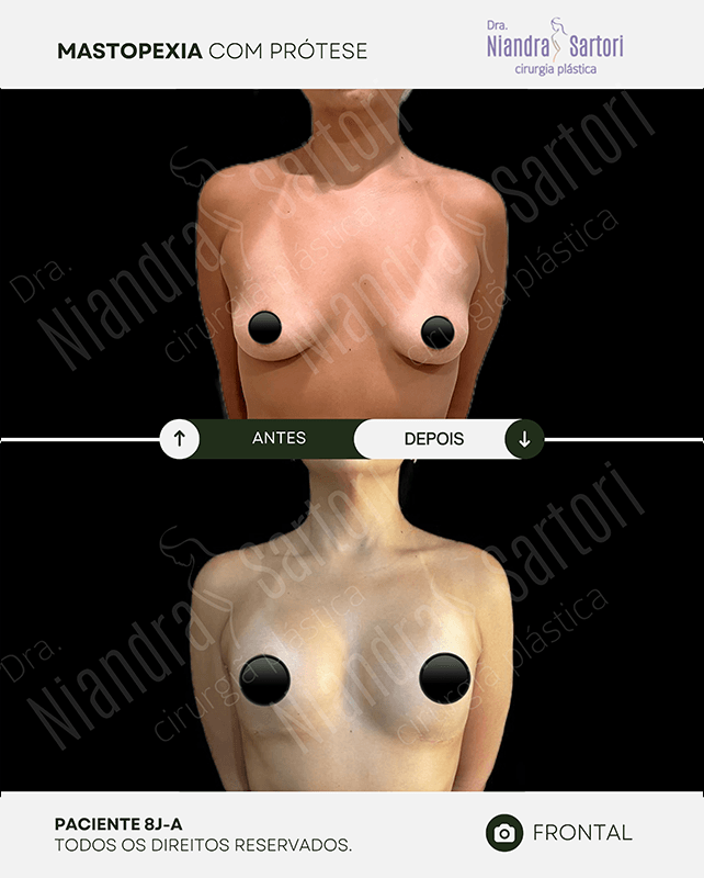 Mamas 2 NS PACIENTE 8J A 2 1